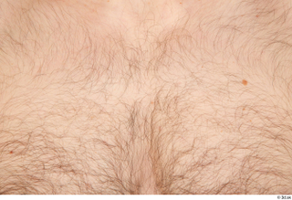 Tomas Salek hairy skin 0002.jpg